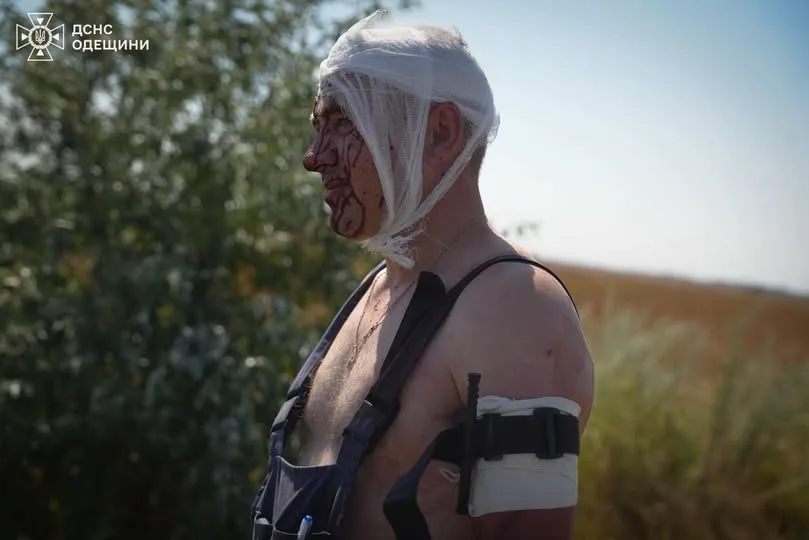 Ворожий удар по Одещині: поранені четверо людей