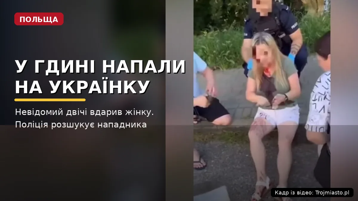 У Гдині напали на українку Невідомий двічі вдарив жінку. Поліція розшукує нападника