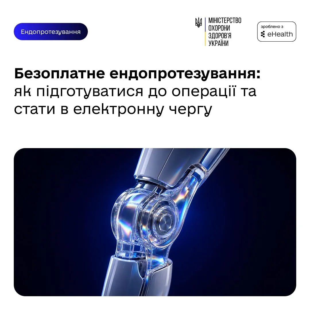 Безоплатне ендопротезування: як стати в електронну чергу та підготуватися до операції