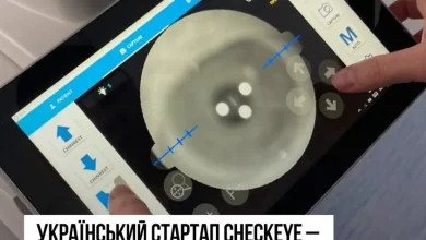 Український медичний стартап CheckEye посів друге місце на глобальному конкурсі у США