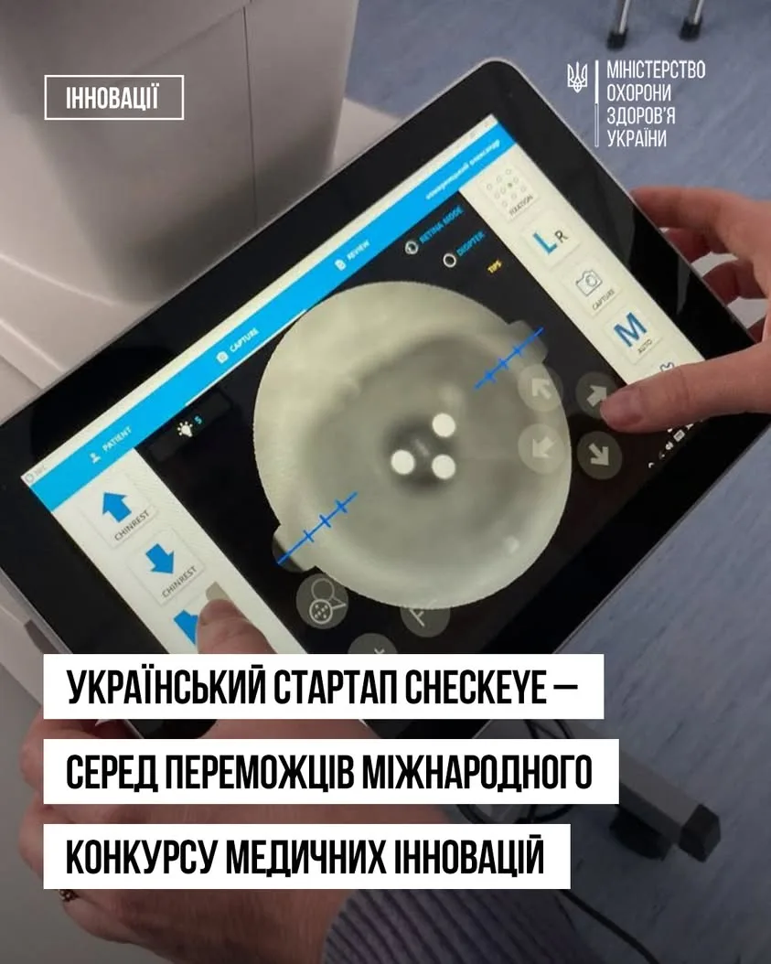 Український медичний стартап CheckEye посів друге місце на глобальному конкурсі у США